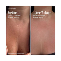 ThisWorks Perfect Cleavage & Neck Serum 150 ml