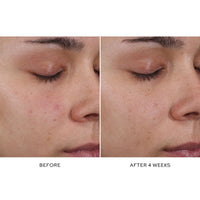 Westman Atelier Pore Refining Complex 15 ml