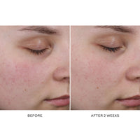 Westman Atelier Pore Refining Complex 15 ml