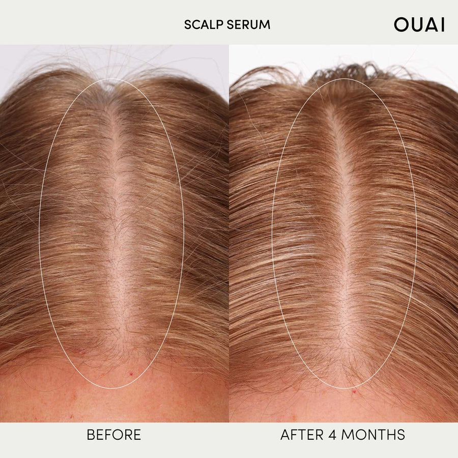 OUAI Scalp Serum 60 ml - Koch Parfymeri